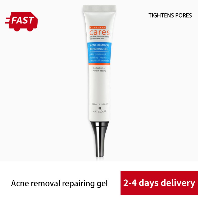 Cream Freckle Extract Acne Removal Scars Marks Treatment Facial Acne Cream Acne Marks Gel