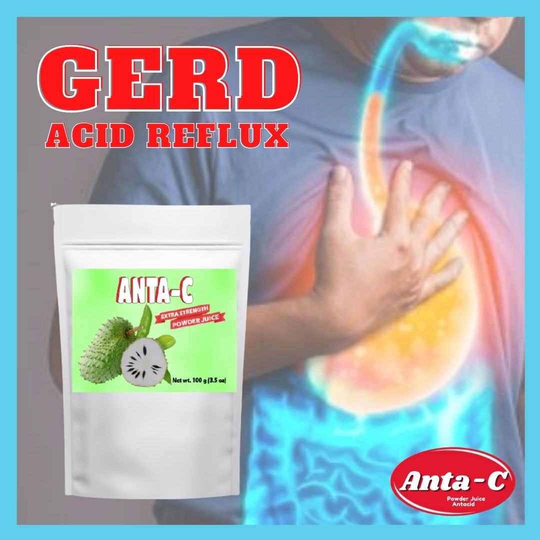 Acid Reflux Anta C Guyabano 200g Acidity Gerd Sour Stomach