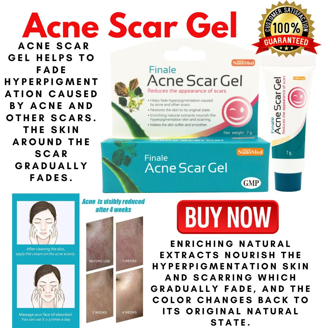 original-finale-acne-scar-gel-reduces-the-appearance-of-scars-oil