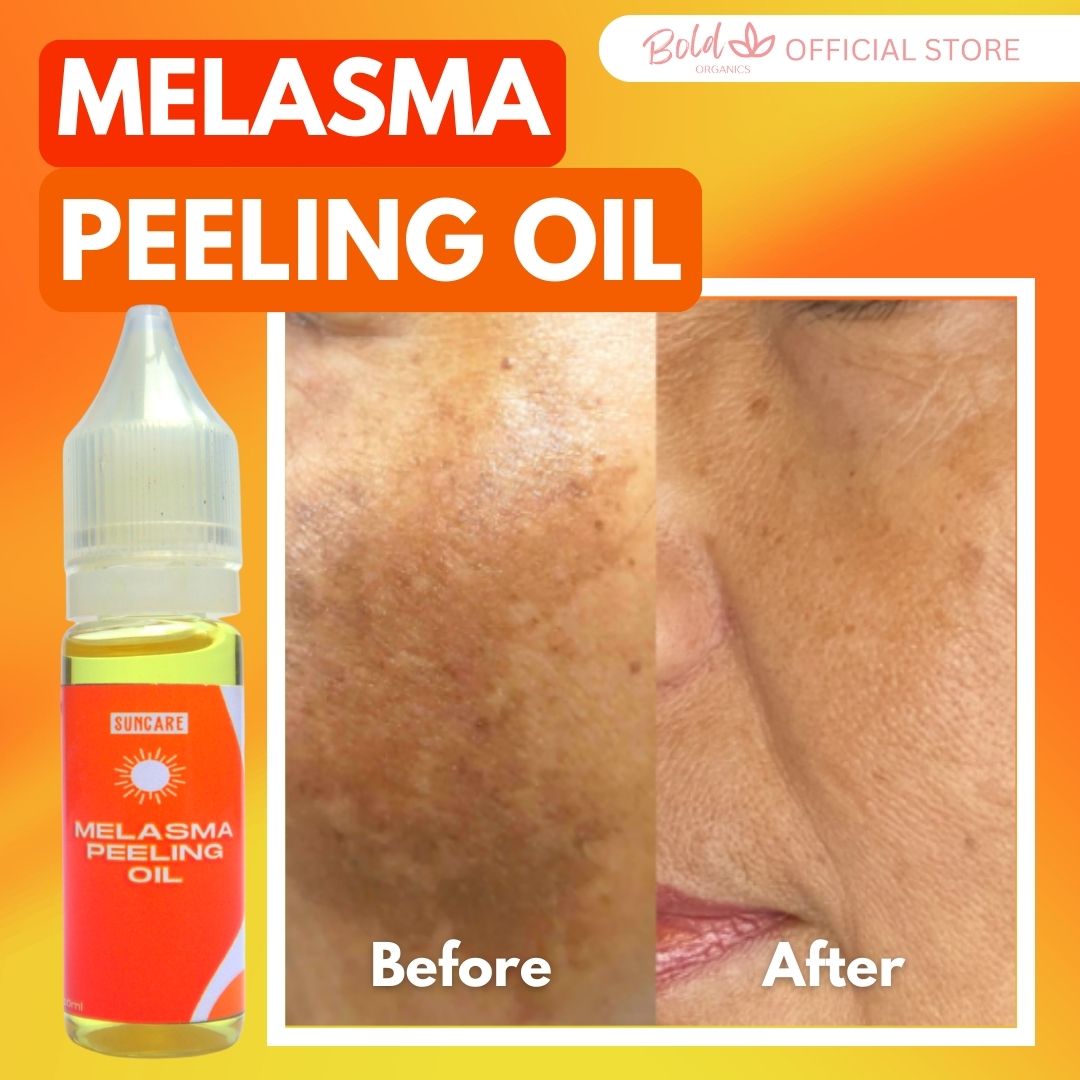 BOLD ORGANIC SUNCARE MELASMA PEELING OIL 10ML AntiMelasma Original Lighten Melasma Brightening