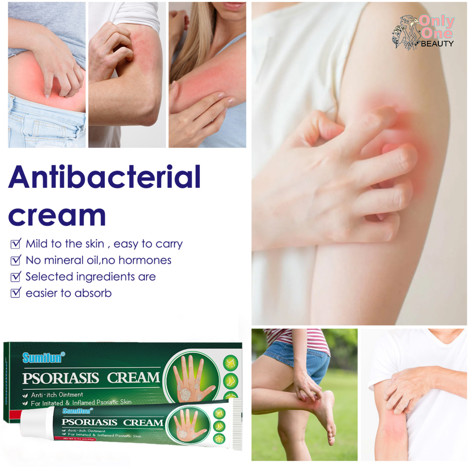 Sumifun Eczema Treatment Cream Gamot Sa Kati Kati Atoderma ...
