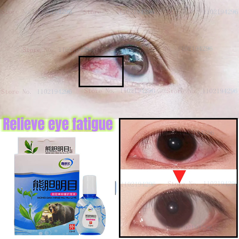 Eye Drops Artificial Tears Formula 15ml eye drops for cataract original