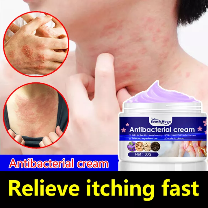 👍ORIGINAL ANTIBACTERIAL CREAM Sweat Herpes Treatment 30g Blisters
