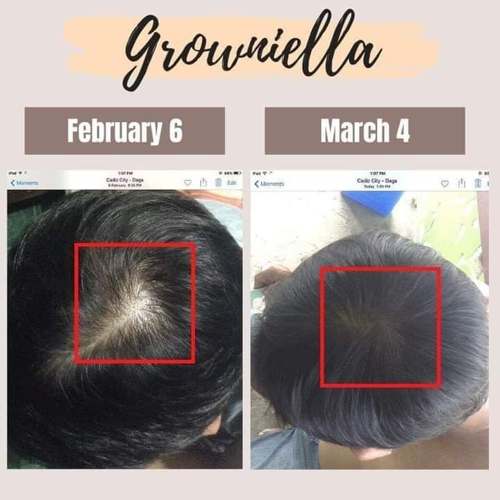 Shermel Shop | Set of 2 GROWNIELLA Hair Growth Spray 3 in 1 Best Seller  Cash on Delivery Eyelash and Eyebrow Hair Grower Legit Men Women Hair  Treatment Anti Dandruff 100ml Ginger