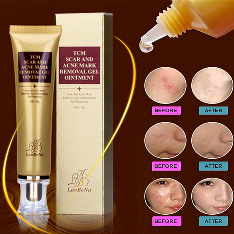 acne scar removal cream for sensitive skin