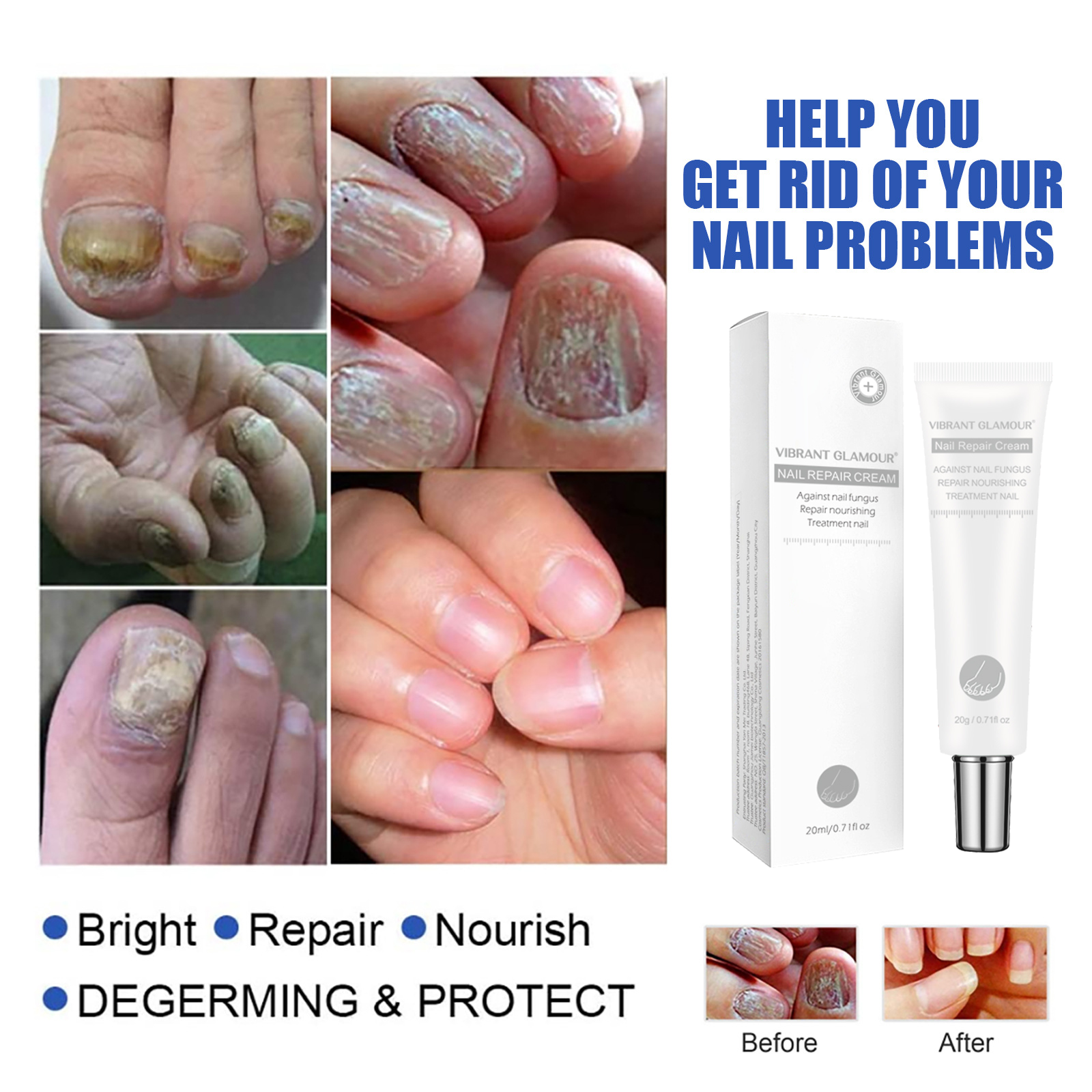 VIBRANT GLAMOUR Nail Repair Cream Onychomycosis Hand and Foot Nail Cream Used to care for cracks