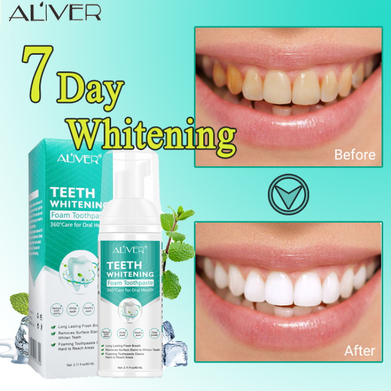 ALIVER Teeth Whitening Teeth Cleaning Mousse Oral Hygiene Toothpaste ...