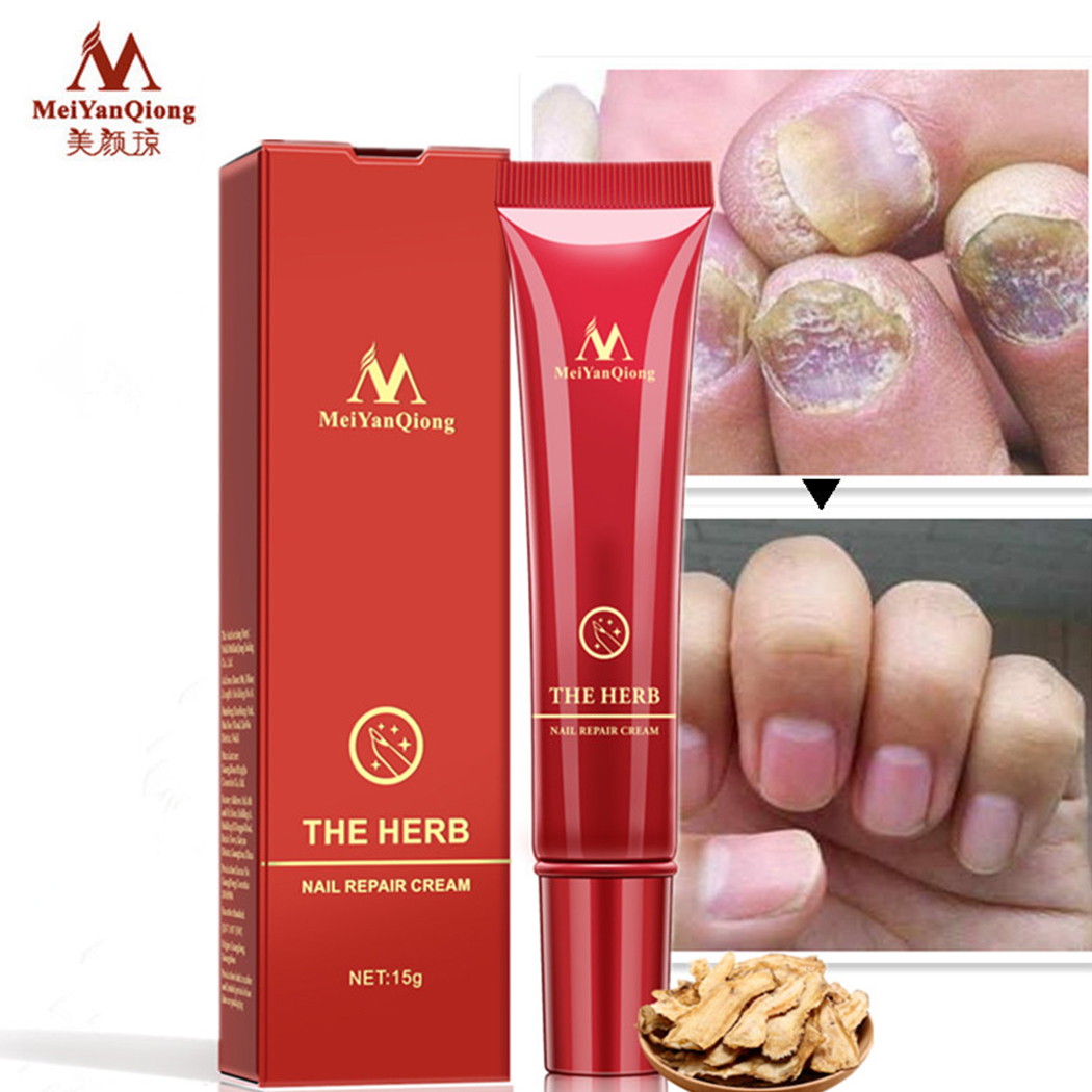 Nail Repair Cream Treatment Cream Natural Herbal Anti Fungal Nail Care Lazada PH