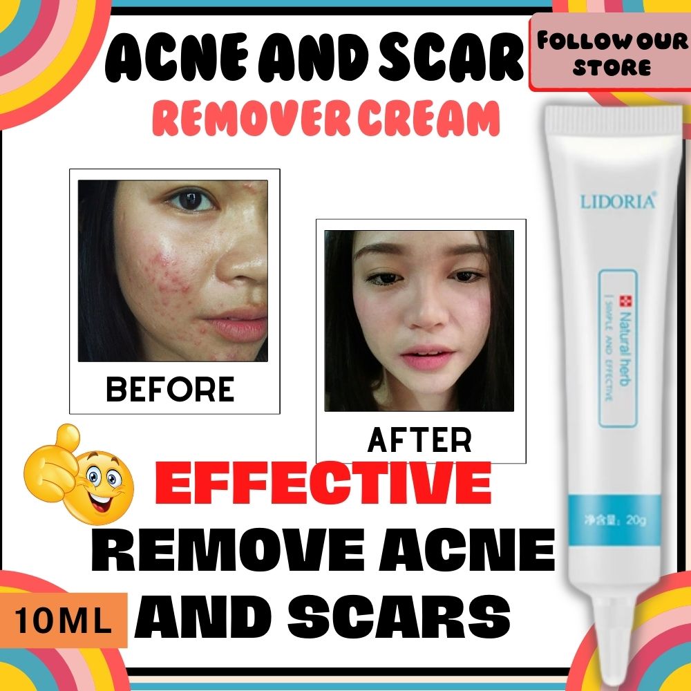 NATURAL AND EFFECTIVE LIDORIA SCAR CREAM Natural Herb Simple and