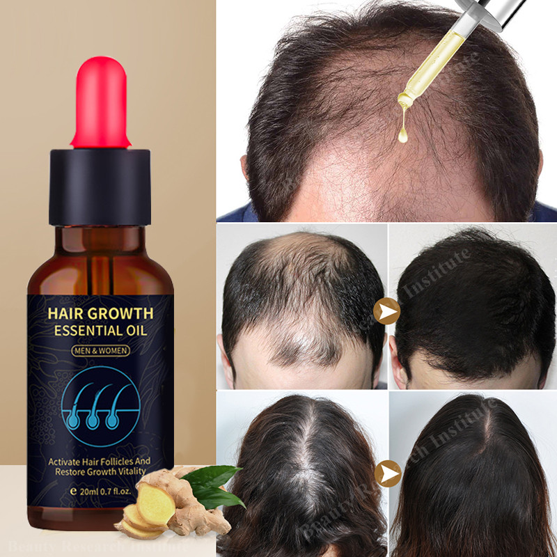 【7 days】Hair grower for men original woman hair growth Root prevention ...