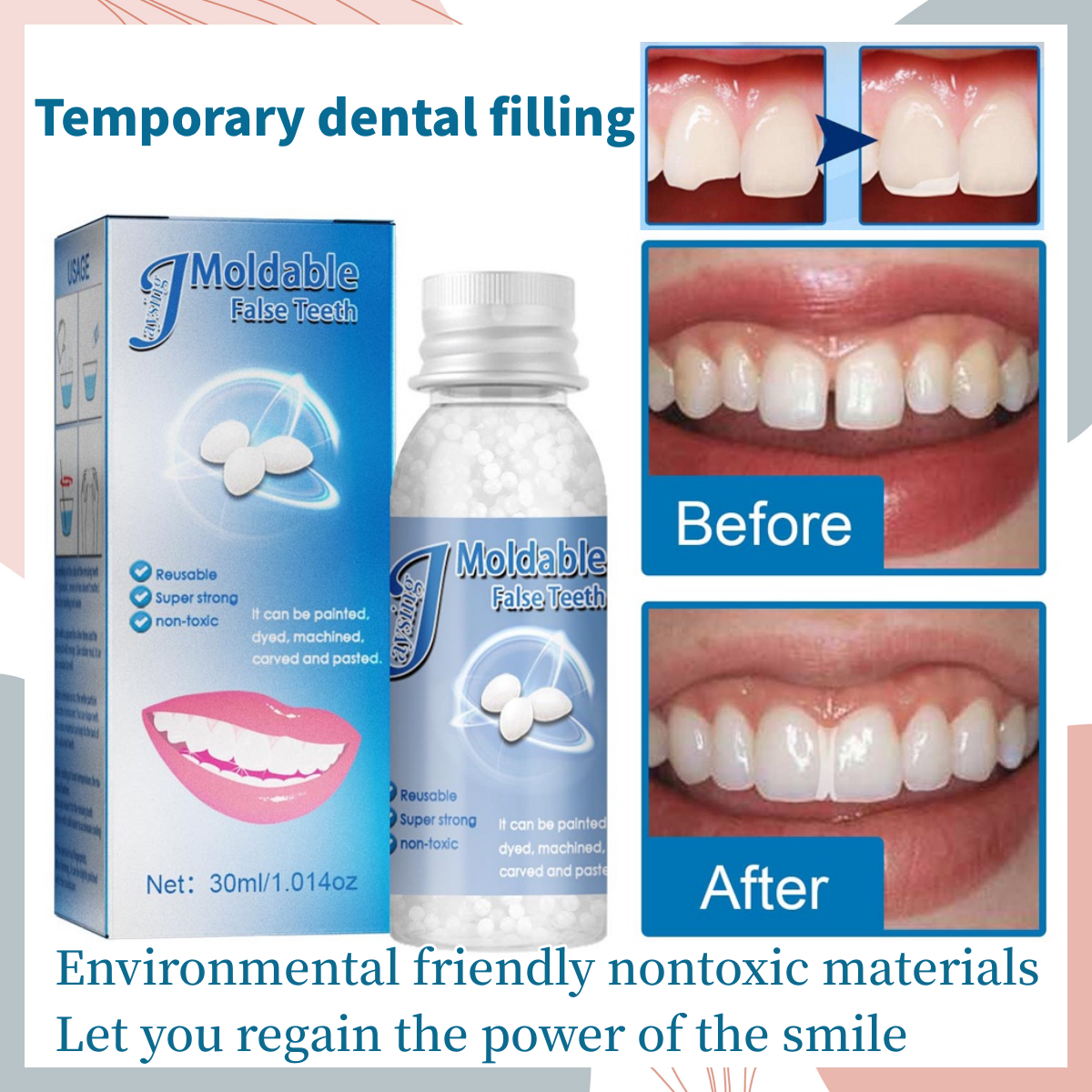 【Fast filling】Temporary Tooth Repair teeth temporary tooth repair kit ...