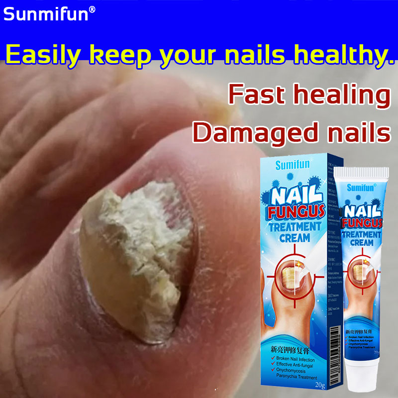 Sumifun Nail Fungus Repair Treatment Foot Care Ointment Anti Fungal ...