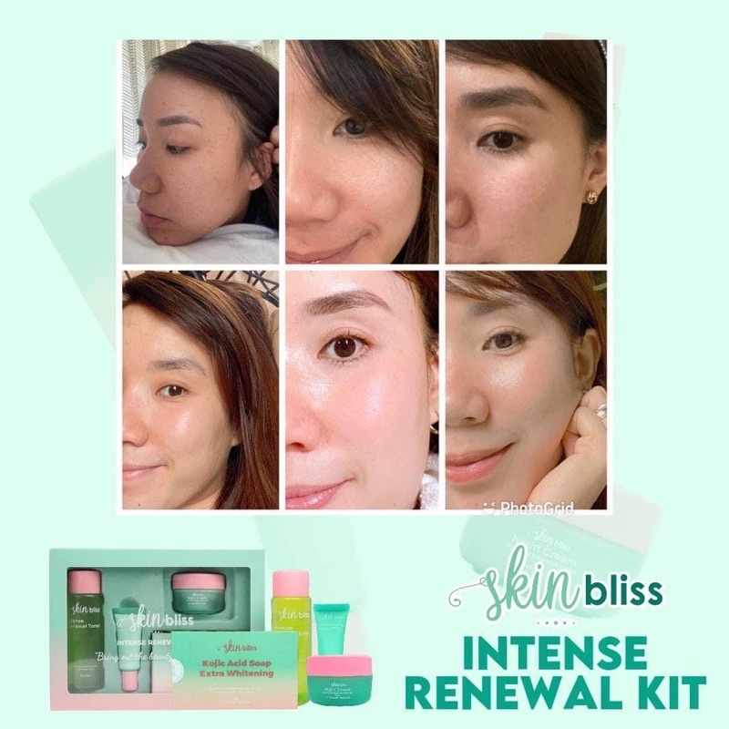 ♨ Skin Bliss Intense Renewal Kit Buy 1 Take 1 Lazada PH