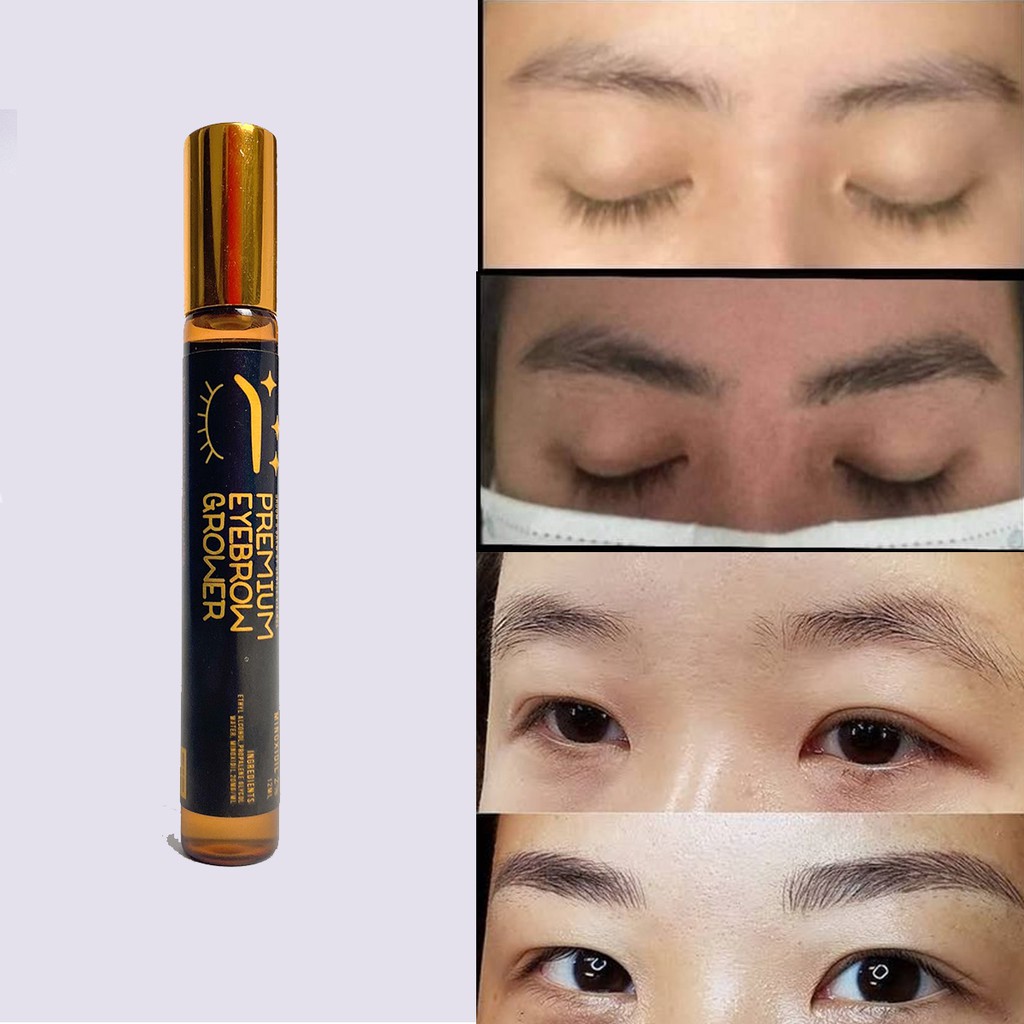 Kilay Grower 2% Minoxidil | Eyebrow Grower | Minoxidil | Legit Hair ...