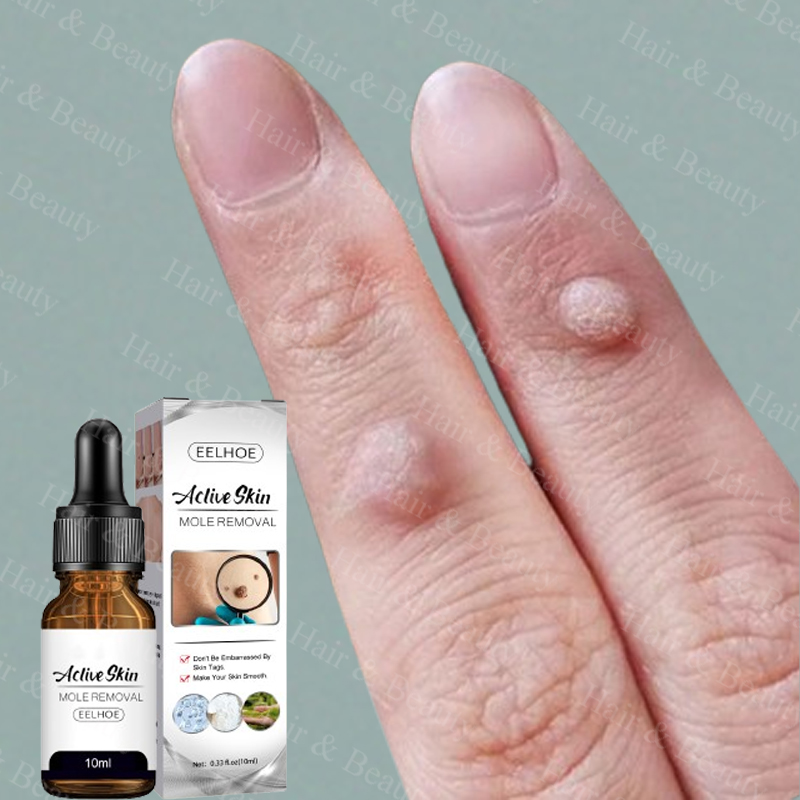 【100 Effective Remover Warts】warts Removal Serum Herbal Extract Safe And Effective Warts 9168