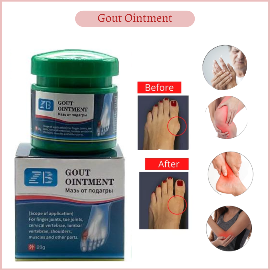 100 ORIGINAL 20g Gout Ointment Treatment Relief for Gout and Arthritis
