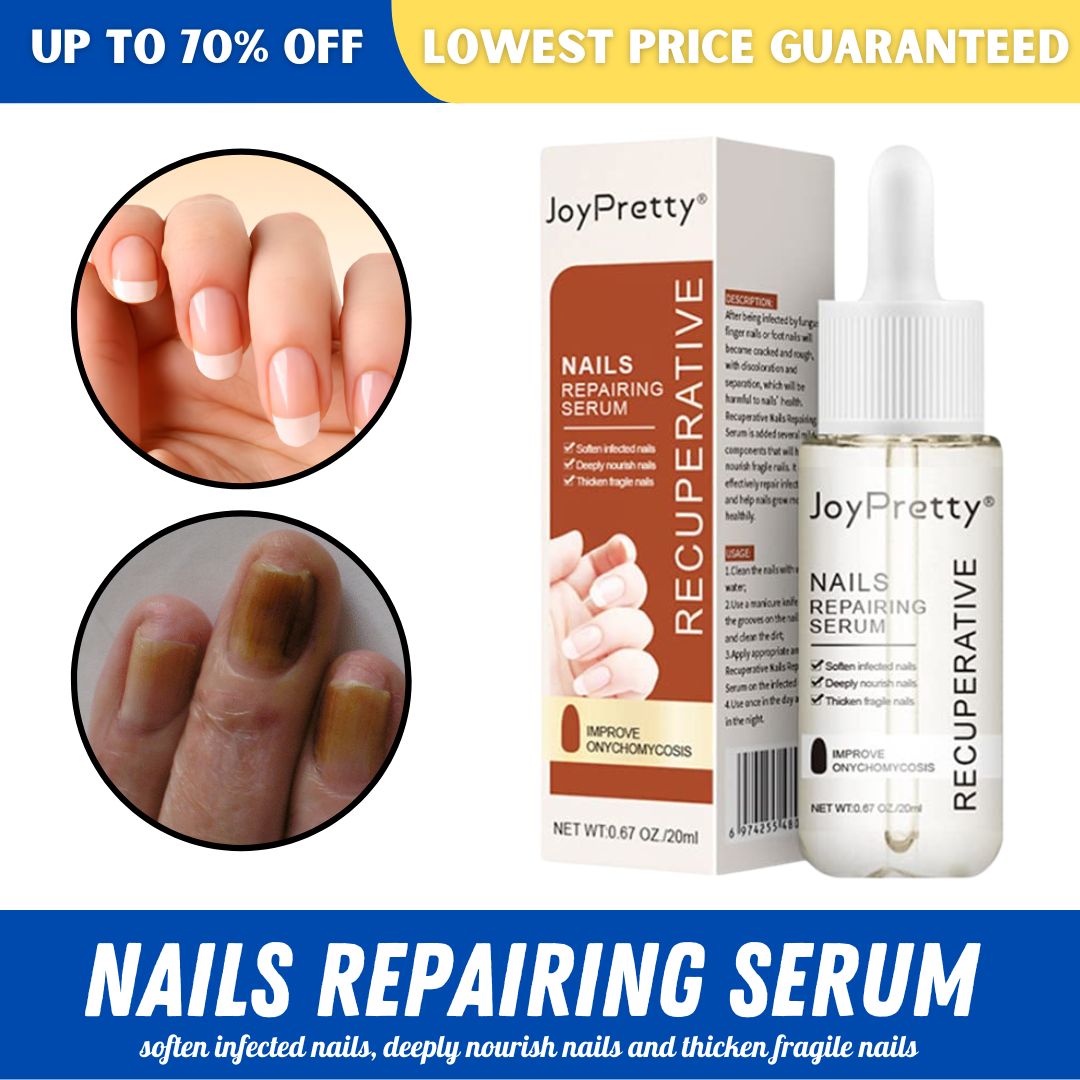 LOWEST PRICE ] Nail Repairing Serum 20ml Onychomycosis Softening Solution  Nails Treatment Oil for Discolored And Damaged Nails White | Lazada PH