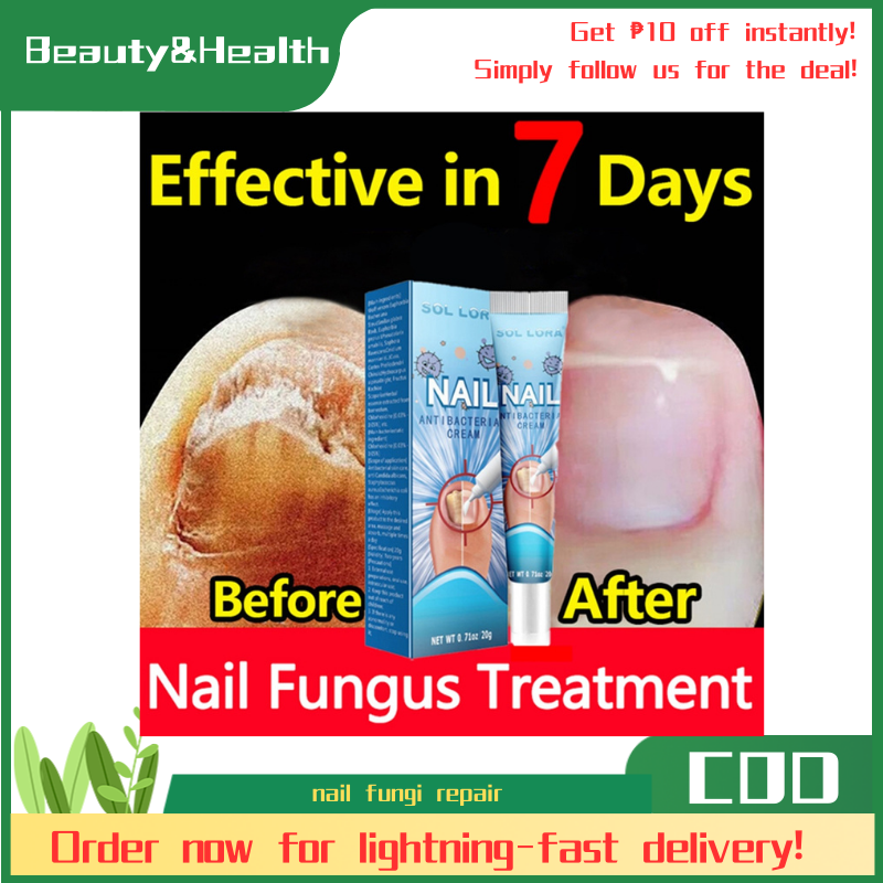 7day effective treatment of fungal paronychia with gray nails removal