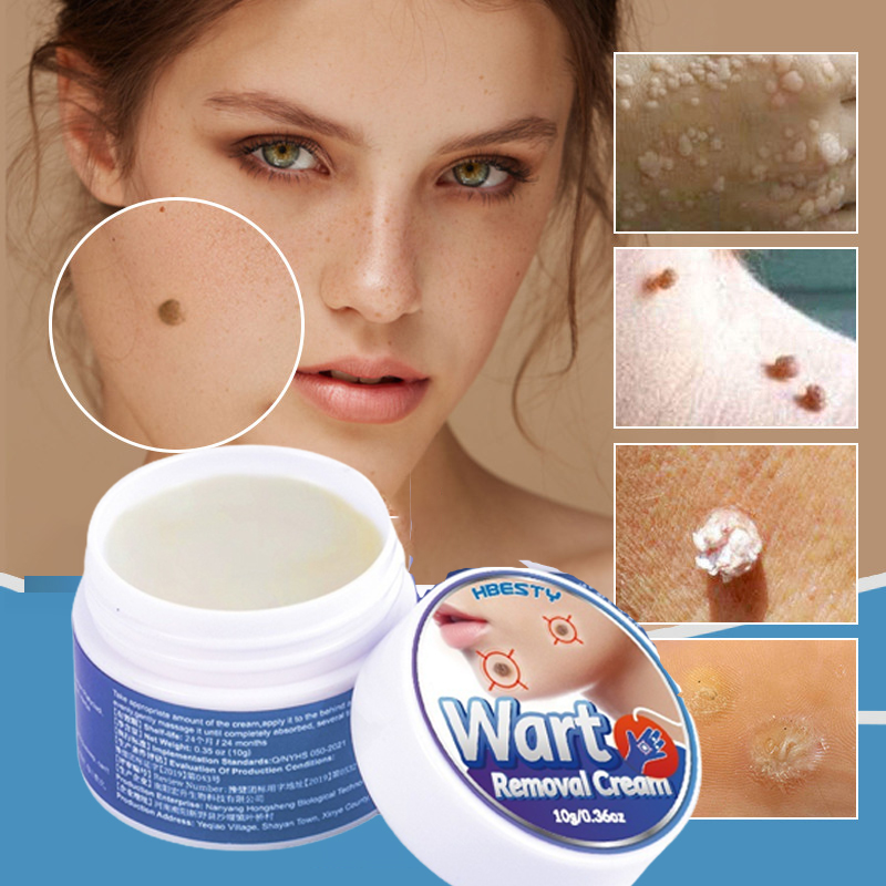 Warts Remover Original Cream Kasoy Oil Removal Warts and Skin Tags