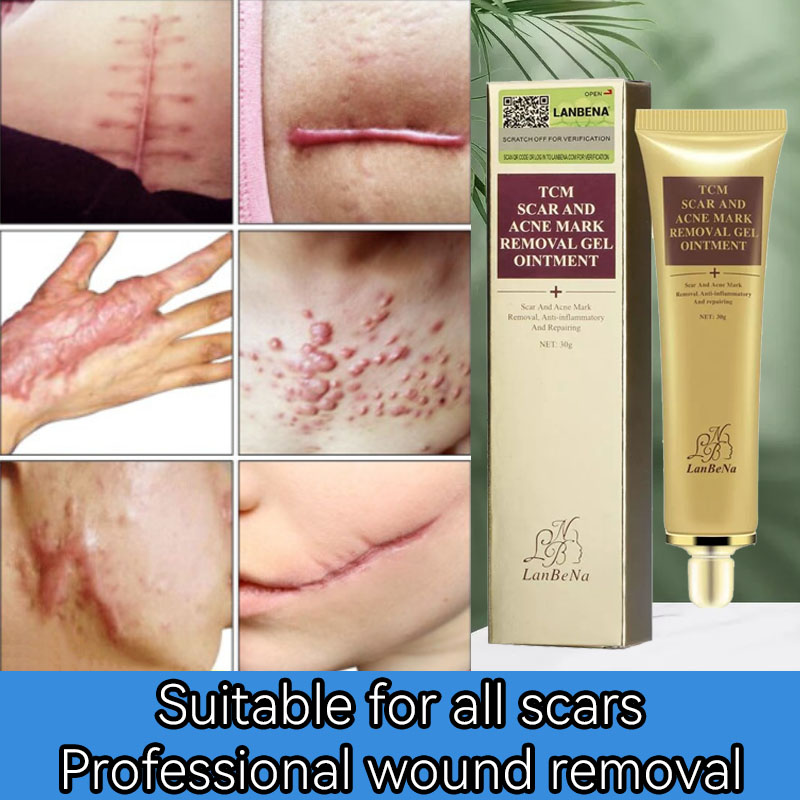 *everybody likes*Scar Removal Cream scar remover for old scar on leg stretch mark remover peklat