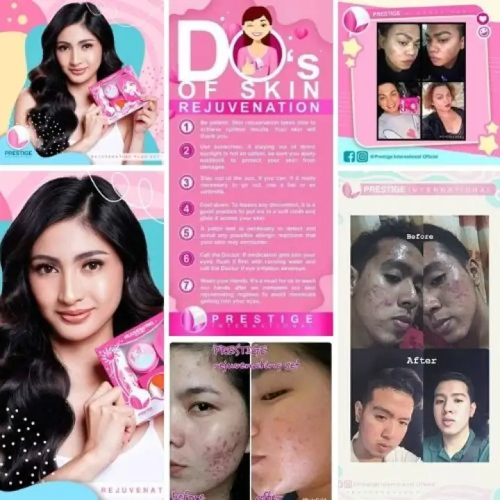 sunscreen for pimple marks