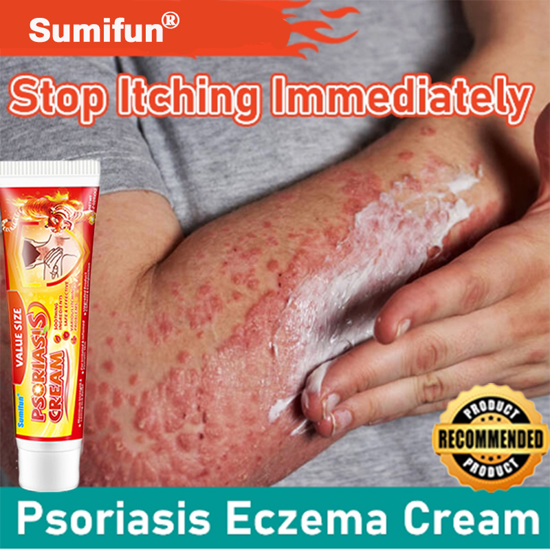 Local delivery Sumifun Psoriasis Cream 60g Herbal Cream Skin Care ...