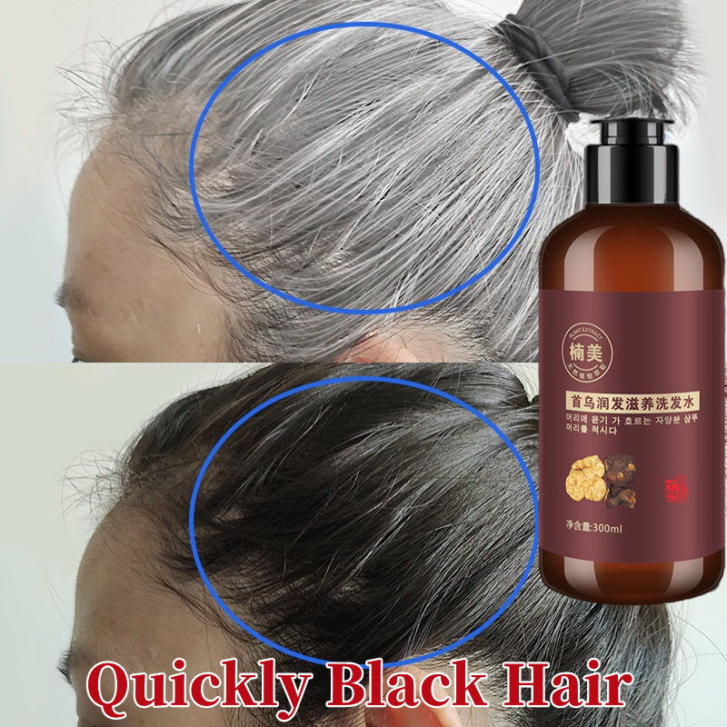 Original NANMEI Polygonum Multiflorum Black Hair Shampoo 300ML