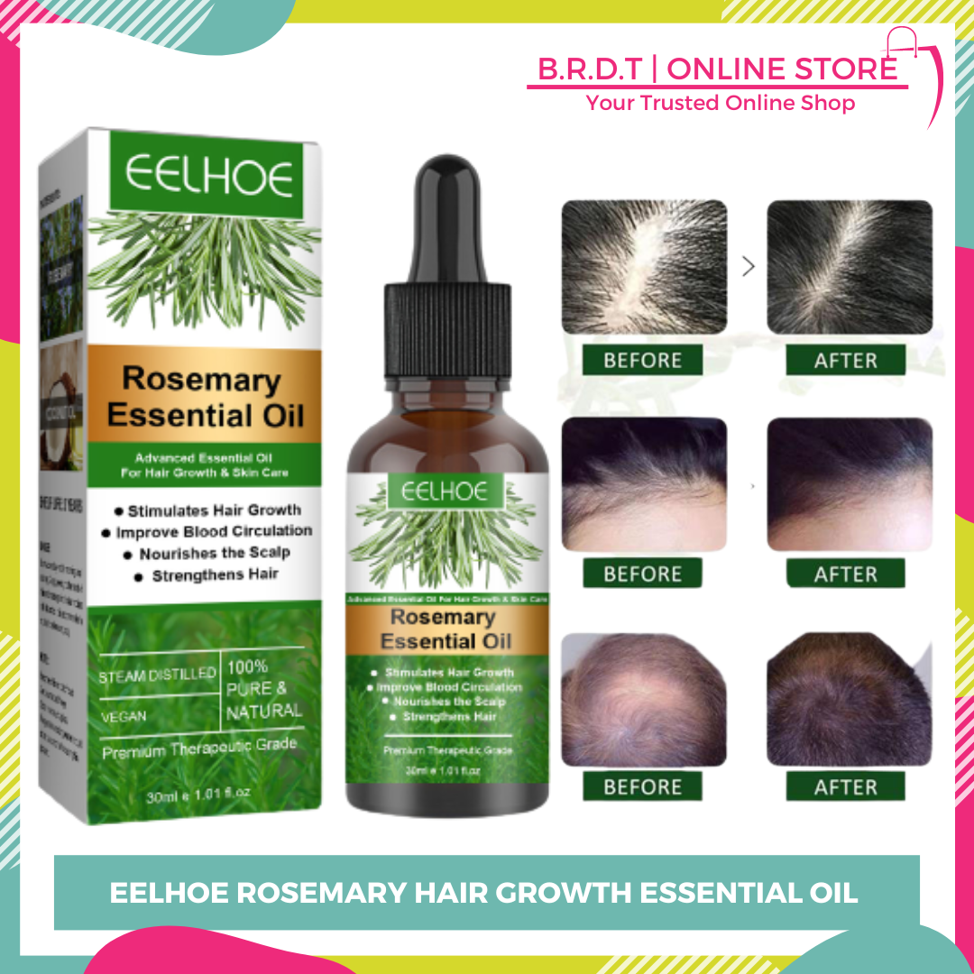 Eelhoe Rosemary Hair Growth Essential Oil Anti Hair Loss Fast Regrowth Essence Aromatherapy 2878