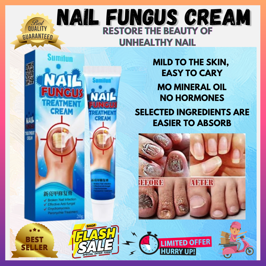 Fungi-Nail, Anti-Fungal Solution, 30mL- Kills Fungus That Can Lead To Nail  Fungus & Athlete's Foot Undecylenic Acid 25% & Clinically Proven to Cure  Fungal Infections : Amazon.ca: Health & Personal Care