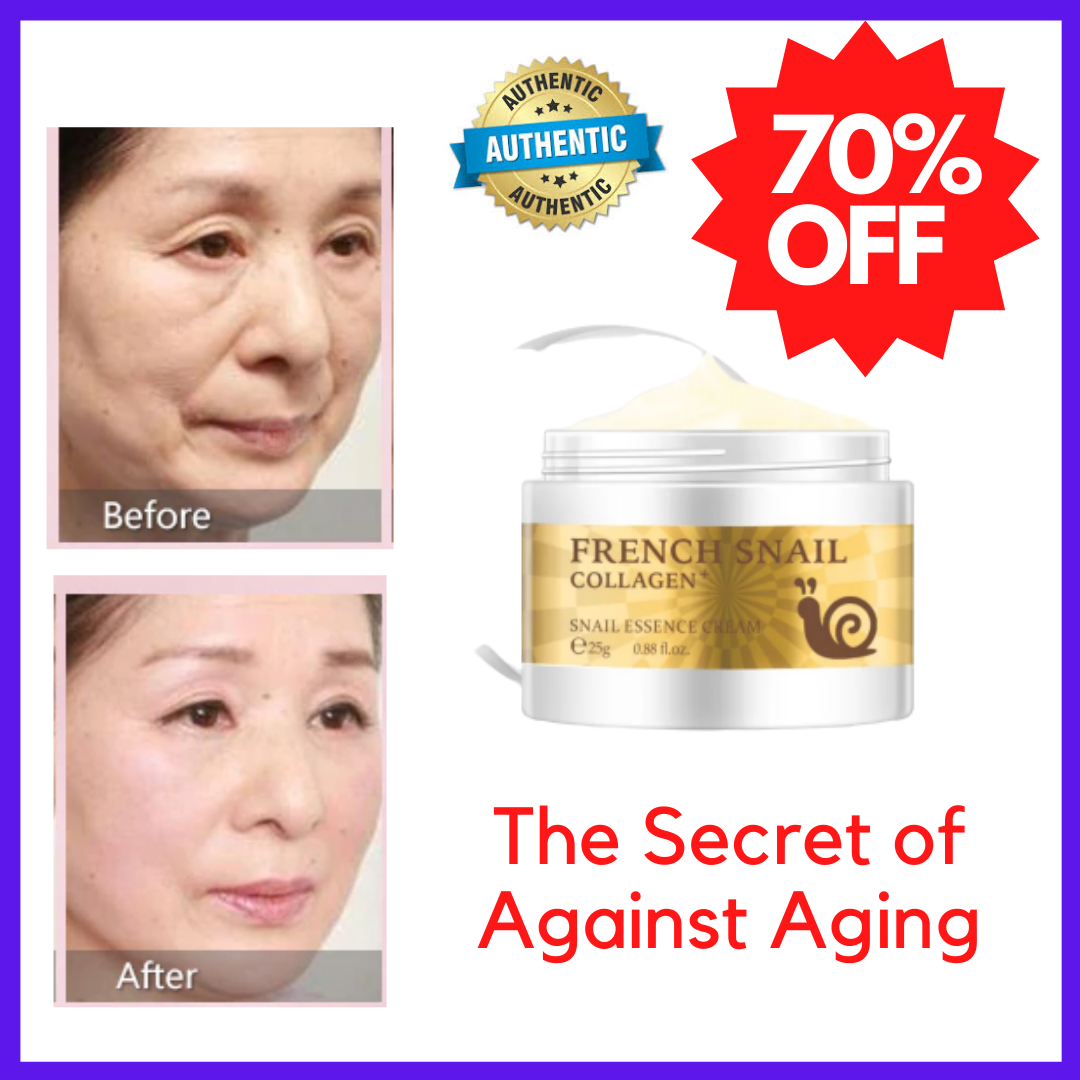 Snail Face Cream Hyaluronic Acid Moisturizer Nourishing Collagen Women Anti  Wrinkle Skin Care Cream Tighten Pores Whitening Anti Aging Cream | Lazada PH