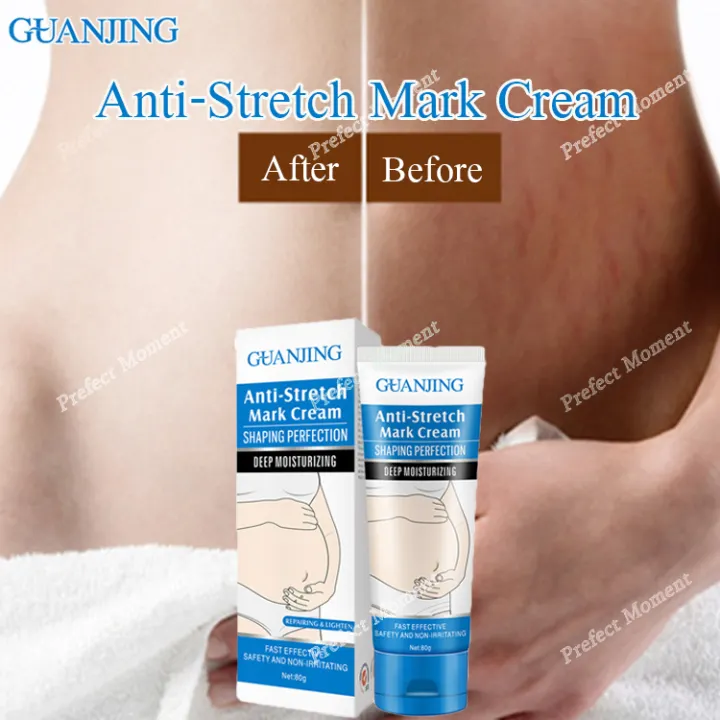 eraser cream for stretch marks