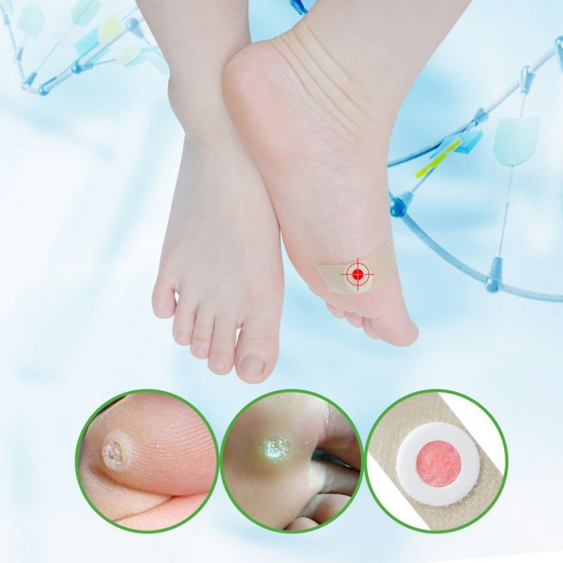 New 2023 42pcs Foot Corn Remover Warts Thorn Patch Relief Pain Foot
