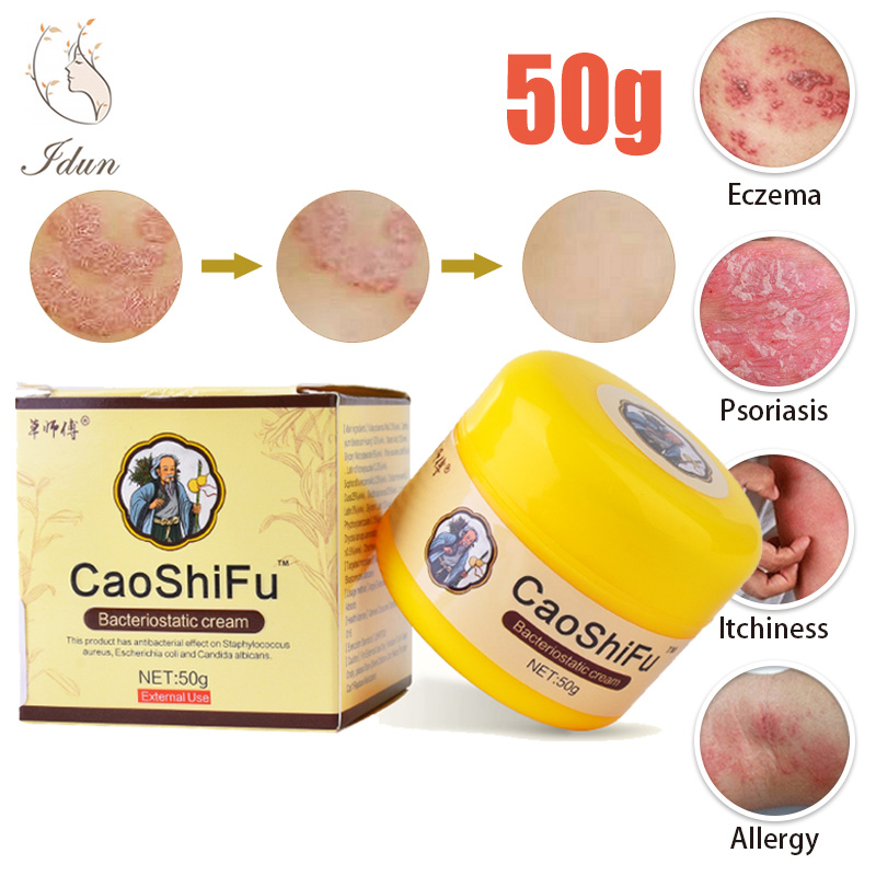 Gambar Idun CAOSHIFU Psoriasis Eczema Treatment Cream ?Topical Medicated Chinese Traditional Herbs Antifungal Ointment for Itchy Skin and Allergy Skin Patches gamot sa kati kati sa balat