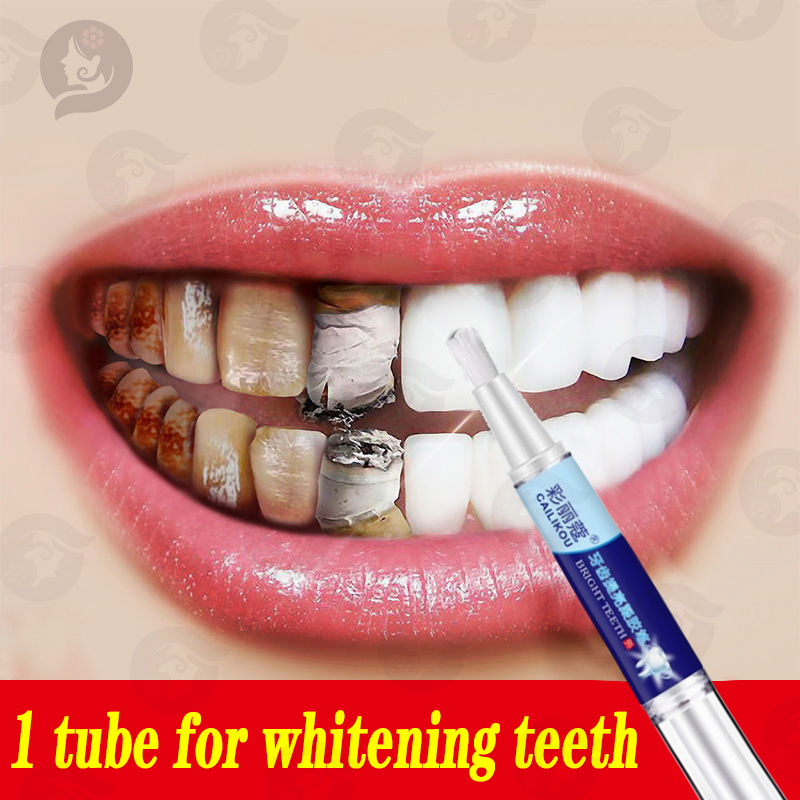 non peroxide teeth whitening gel