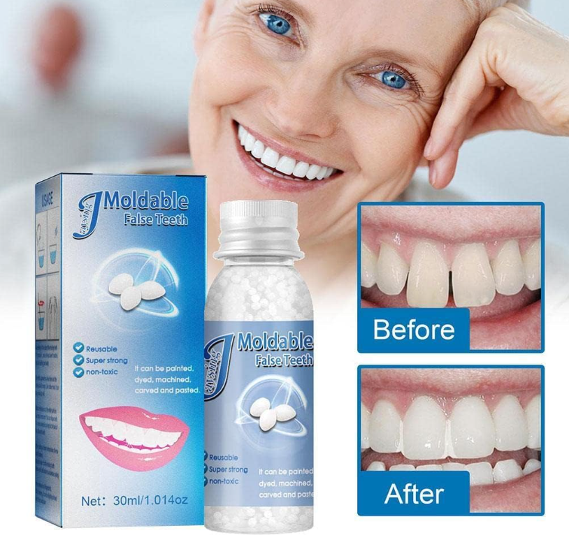 UPSTYLE Moldable False Teeth Temporary Tooth Repair Kit For