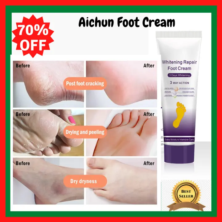 foot crack best ointment