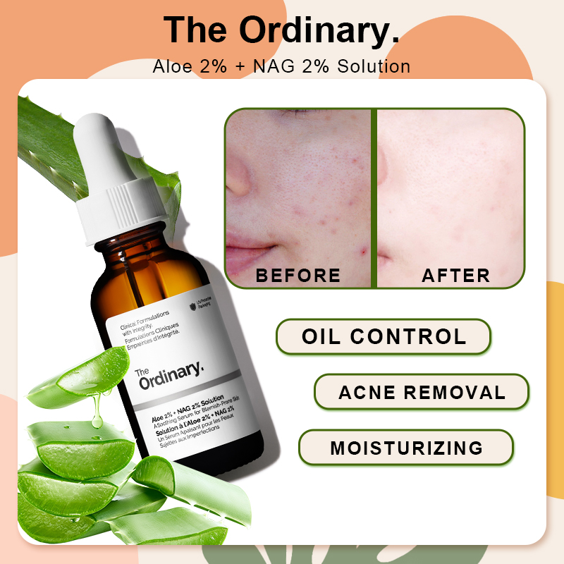 The Ordinary Aloe 2% + NAG 2% Solution face serum soothing post-acne marks  Shrink pores moisturizing reduce redness Moisturizing Acne Care Serum Dry  Skin 20S Masstige Serum - Lazada | Lazada PH