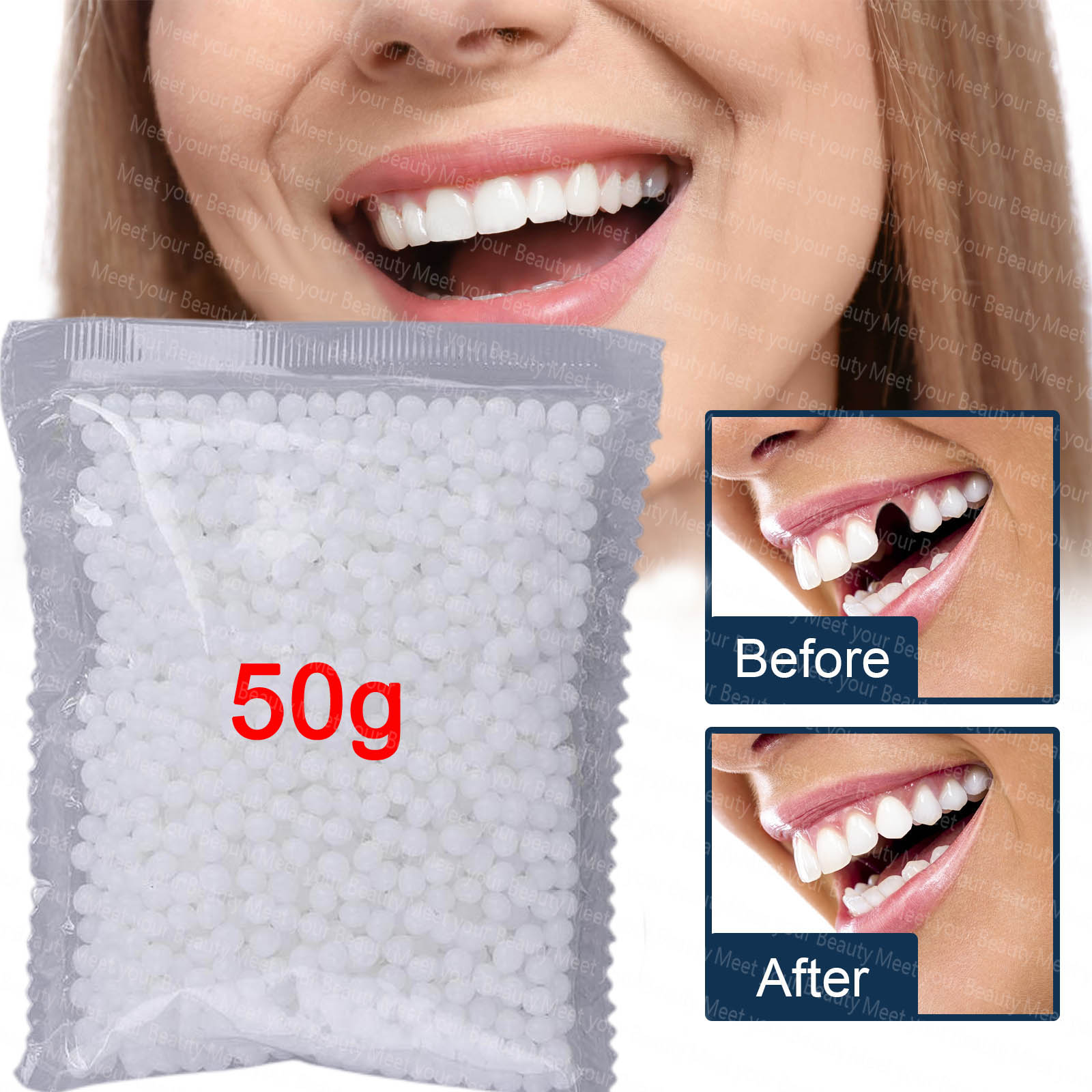 Temporary Tooth Repair Kit Teeth And Gaps FalseTeeth Solid Glue Denture  Adhesive 50g 