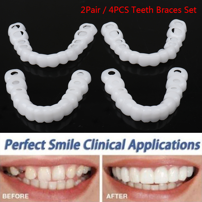 Xinze 2pair Dental Orthodontic Beauty Teeth Corrector Braces Tooth Retainer Straighten Lazada