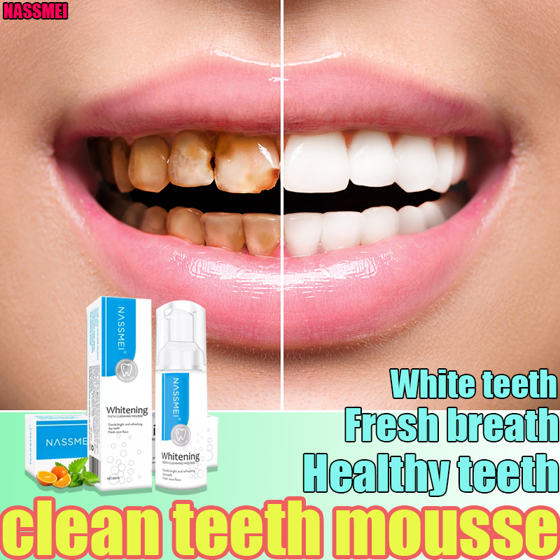 NASSMEI Teeth Whitening Tooth Mousse Whitening Mousse Whitening powder