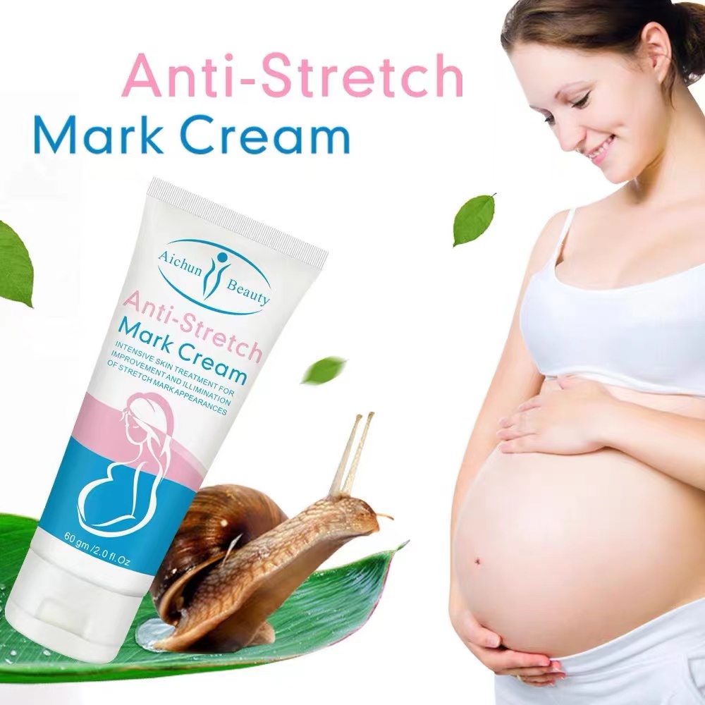 STRETCH MARK REMOVER CREAM skin care products for men and pregnant