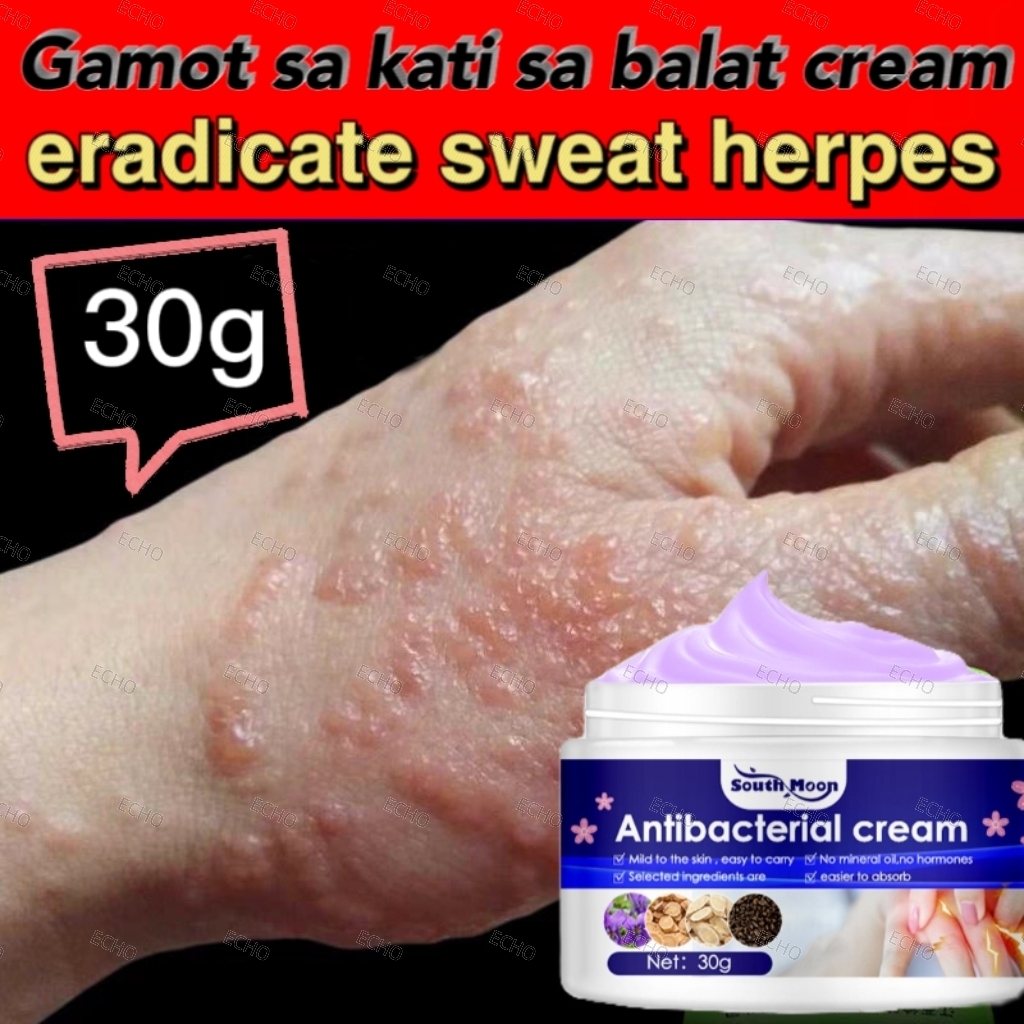 3 Seconds To Relieve Itching Sweat Herpes Treatment Antibacterial Cream