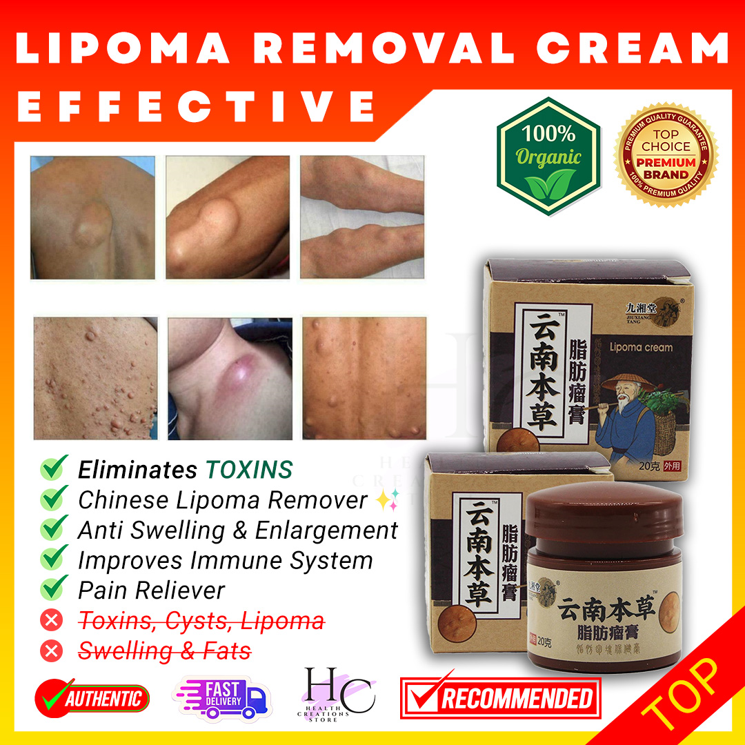 JIUXANG Lipoma Removal Cream Original Lipoma Cream Bukol Original from