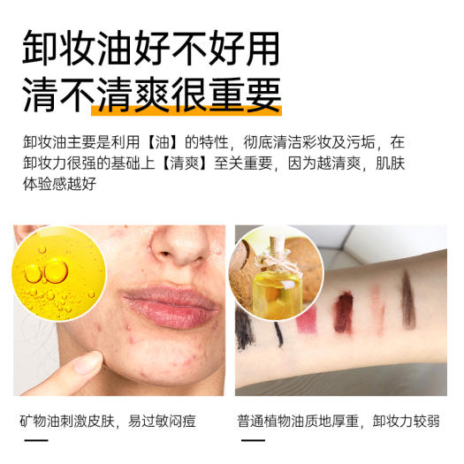 Dầu tẩy trang rnw nữ thủy đậu mụn cơ mắt môi mặt ba trong một để nhũ hóa mụn đầu đen nhanh chóng hàng đầu danh sách xếp hạng chính thức