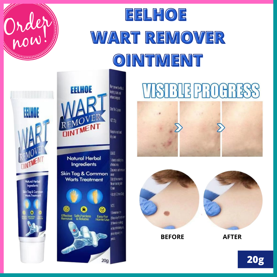 FAST EFFECT! Warts remover original Kulugo Remover cream Natural Herbal ...