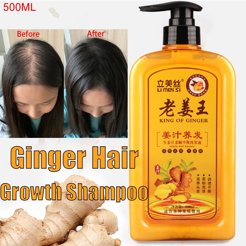 Ginger Wang King Of Ginger Anti Hair Loss Ginger Shampoo I Ginger Hair Growth Shampoo 3128