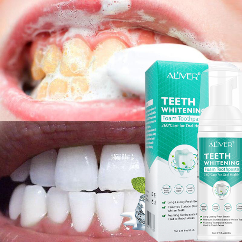 【Original】ALIVER Teeth Whitening Mousse Toothpaste Teeth Whitening