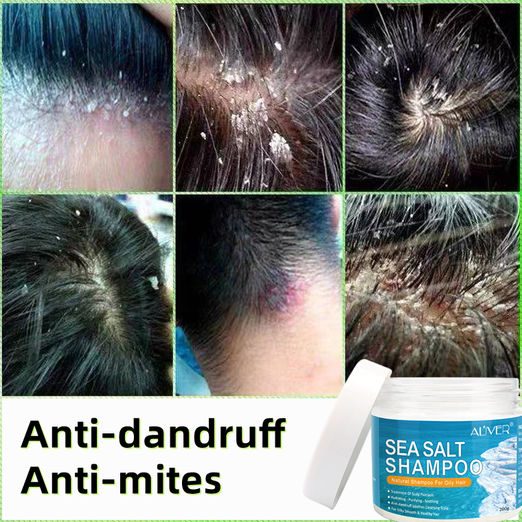 ALIVER Sea Salt Anti Dandruff Shampoo For Dandruff and Scalp Treatment