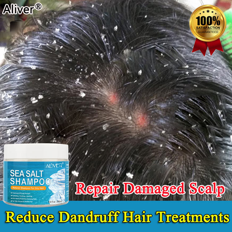 Aliver Sea Salt Anti Dandruff Shampoo For Dandruff And Scalp Treatment Fast Growth Removal Mites