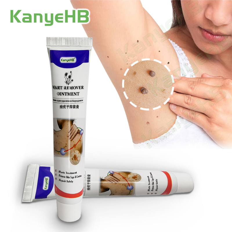 Kanyehb Warts Removal Cream Skin Tag Wart Remover Feet Corns Plaster Ointment Medical Wart Cream 0104